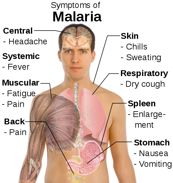 malaria